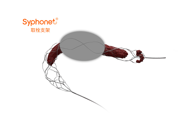 Syphonet?取栓支架